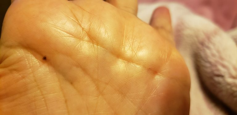 手 に ほくろ 急 に – 手のひら ほくろ 右手 突然 | 手相のほくろの見方！指別・手のひらの位置で意味が変わる！ – UWXOE